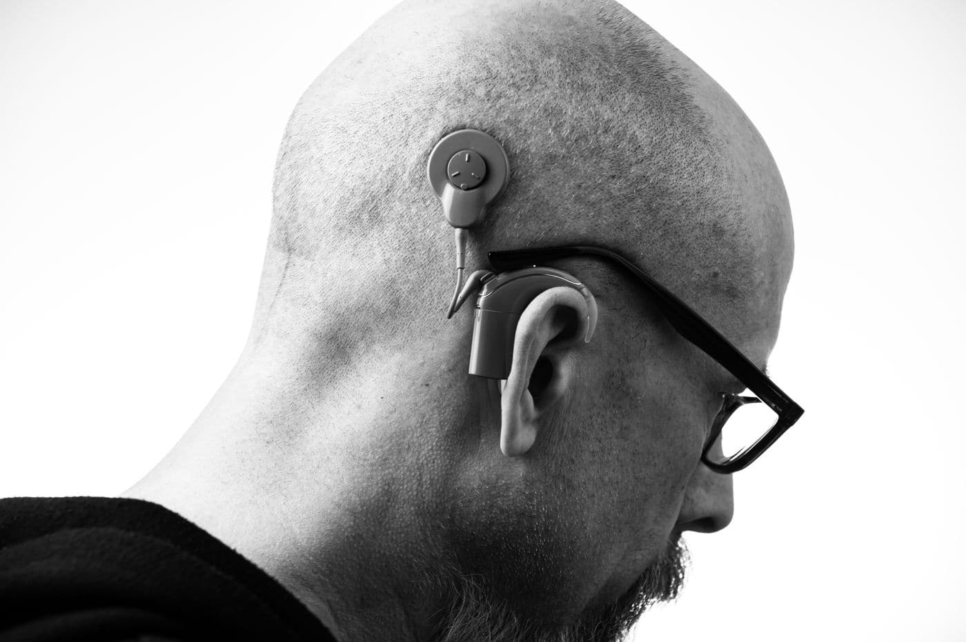 Close-up of a hearing aid worn behind the ear